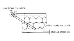 Occlusal wear evaluation apparatus and occlusal wear evaluation method