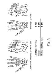 Use of TNFalpha Inhibitor