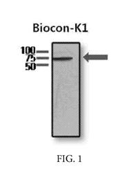 ANTI-KRS MONOCLONAL ANTIBODY AND USE THEREOF