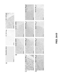 VH4 ANTIBODIES AGAINST GRAY MATTER NEURON AND ASTROCYTE