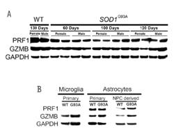 Compositions and methods for treating amyotrophic lateral sclerosis