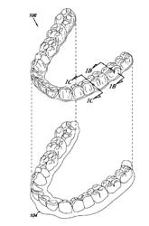 DENTAL MATERIALS USING THERMOSET POLYMERS