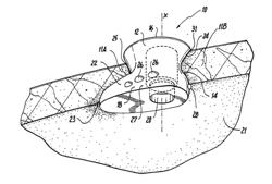 ACCESS DEVICE WITH ANCHORING BODY AND MODULAR INSERTS AND SUPPORT STRUCTURE FOR SUPPORTING ACCESSORIES USED IN MINIMALLY INVASIVE SURGICAL PROCEDURES