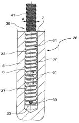 Anchoring sleeve