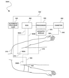 NON-INVASIVE BLOOD PRESSURE MEASUREMENT SYSTEM