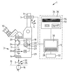 Method for determining the azimuthal orientation of a patient eye and eye surgical apparatus therefor