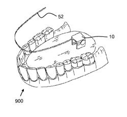 Device and method for stimulating salivation