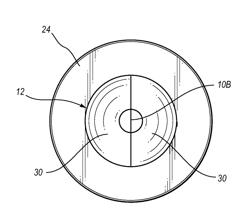 Extensible internal bolster for a medical device