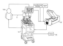 METHODS AND SYSTEMS FOR PROCESSING AND WASHING A PHOTOPHERESIS MONONUCLEAR CELL PRODUCT