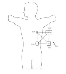 PERSONALIZED PARAMETER MODELING METHODS AND RELATED DEVICES AND SYSTEMS