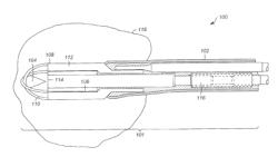 Radially-firing electrohydraulic lithotripsy probe