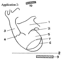 Flexible magnetic membrane based actuation system and devices involving the same