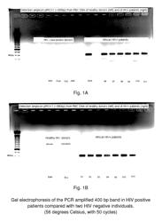 System and method for the detection and treatment of infection by a microbial agent associated with HIV infection