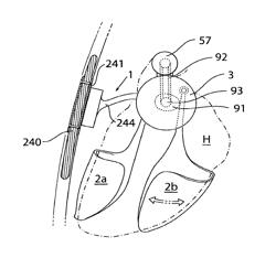 Heart help device, system and method