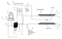 Parameter-Free Denoising of Complex MR Images by Iterative Multi-Wavelet Thresholding