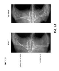 Use of IL-18BP for treatment of peripheral vascular diseases