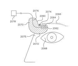 APPARATUS AND METHOD FOR MEASURING BIOLOGIC PARAMETERS