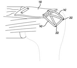 JOINT KINEMATIC RECONSTRUCTION TECHNIQUES