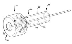 Deployable joint infection treatment system