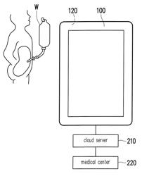 Image analysis method and apparatus for assessment of peritoneal dialysis complication in peritoneal dialysis