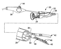 Tissue welding and cutting apparatus and method