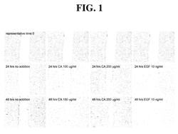 METHODS AND COMPOSITIONS FOR TREATING WOUNDS UTILIZING CHITOSAN COMPOUNDS