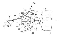 Adjustable MRI head coil apparatus and MRI system