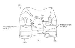 Femoral implant for preserving cruciate ligaments