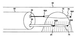 Endoscopic resection device