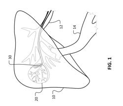 METHODS AND SYSTEMS FOR THERMOEMBOLIZATION