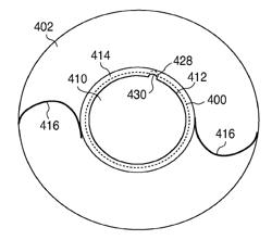 Method for creating incisions to improve intraocular lens placement