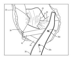 Center side impact airbag module with control tether