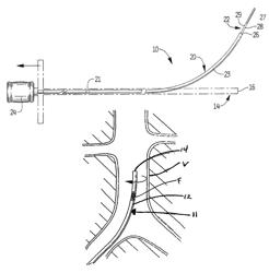 Method of inserting a vein filter