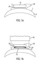 Dental compositions containing upconversion phosphors and methods of use