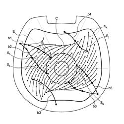 Lightning protection system for radome and associated assembly method