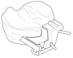 Patient Selectable Joint Arthroplasty Devices and Surgical Tools