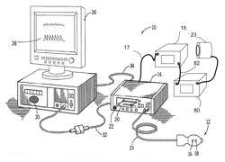 Systems and methods for maintaining blood pressure monitor calibration