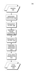 Non-touch optical detection of vital sign from amplified visual variations