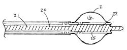 Apparatus and methods for administering treatment within a bodily duct of a patient