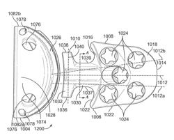 VARIABLE ANGLE BLADE AUGMENT