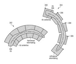 Method and apparatus for generating an enhanced image from medical imaging data