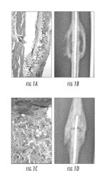 MATRIX FOR ENHANCED DELIVERY OF OSTEOINDUCTIVE MOLECULES IN BONE REPAIR