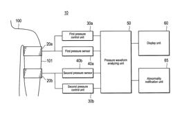 Venous pressure measurement apparatus