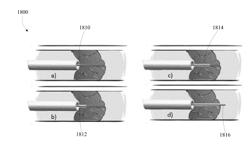 PLACID WIRE MECHANISM OF PENETRATING BLOCKINGS AND OCCLUSIONS IN ARTERIES