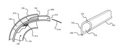 Tissue slitting methods and systems