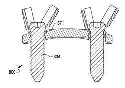 Orthopaedic plate