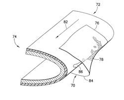 Method for repairing an airfoil surface having an elastomeric protective coating