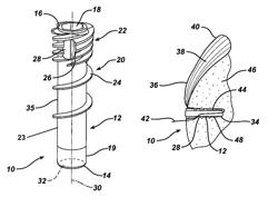 Knotless suture anchor with unthreaded nose