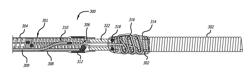 IMPLANT DELIVERY SYSTEM