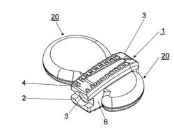 Intervertebral Prosthesis or Disk Prosthesis